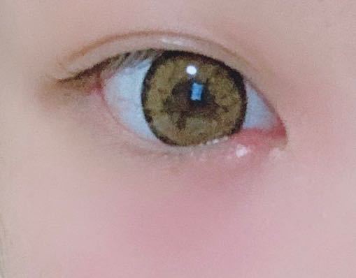 数日前に下まぶたが腫れてきて薬局でものもらい結膜炎用の目薬を Yahoo 知恵袋