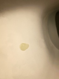 画像閲覧注意 婦人科疾患 オリモノについての質問です下記の症状はなん Yahoo 知恵袋