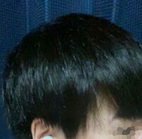 前髪の横側に隙間が出来るのですがハゲでしょうか Yahoo 知恵袋