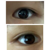 自分は一重から二重になったのですが最初は右目も左目のような二 Yahoo 知恵袋