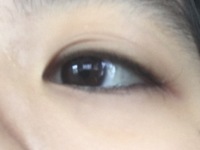 朝起きたら 片目のまぶたが変になっていました 今までは写真の右の Yahoo 知恵袋