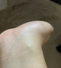 これは 右の手首の内側です ふと見てみたら しこりのようなも Yahoo 知恵袋