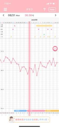 無排卵でしょうか 病院で10日にタイミング取るように言われ 排卵 Yahoo 知恵袋