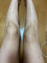 ここ数年足の掻き傷跡 虫刺され跡等が治らず困っています どの皮膚科受診 Yahoo 知恵袋