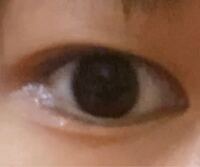 アイプチのしすぎで失明しかけてるかもしれません 読んでいただきありがとうござい Yahoo 知恵袋