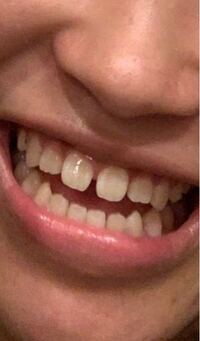 欧米ではすきっ歯はセクシーなんですか 友達が言ってたん Yahoo 知恵袋