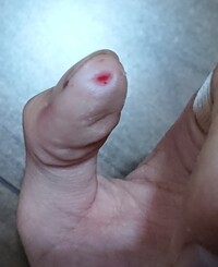昨日カミソリで指を切ってしまって 洗ってから絆創膏をしました 今傷口が Yahoo 知恵袋