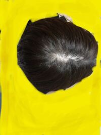 30歳の女です ここ数年 頭頂部の分け目あたりが薄くなっている気 Yahoo 知恵袋