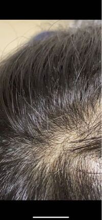 この頭皮の色は大丈夫ですか 何色ですか Yahoo 知恵袋