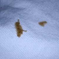 輪ゴムが溶けてtシャツに画像のように汚れ くっついてしまいま Yahoo 知恵袋