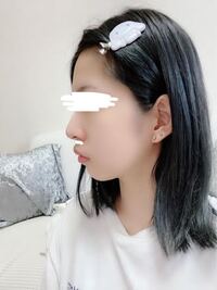 これって口ゴボですか 顎が引っ込んでいるんでしょうか Yahoo 知恵袋