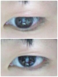 伸びた瞼をマッサージとかで直った方いますか 二重マッサージ1 眉下 Yahoo 知恵袋