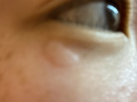 の 目 の 痒み 周り 目の周りが赤い時の原因と病気の種類！痒い時や幼児の場合も！