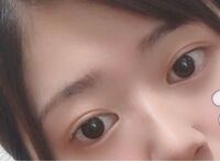 まぶたの薄い一重ですぐにたるみます でも二重になりたいです い Yahoo 知恵袋