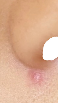 中学女子です 下に写真あります 見たくない人飛ばしてくだ Yahoo 知恵袋