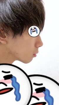 僕の横顔なんですがアデノイド顔貌ってやつですか 口ゴボですか あ Yahoo 知恵袋