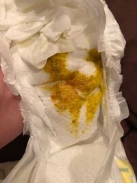 ウンチの画像あり 生後2ヶ月の女の子を育てています 先程おむつを Yahoo 知恵袋