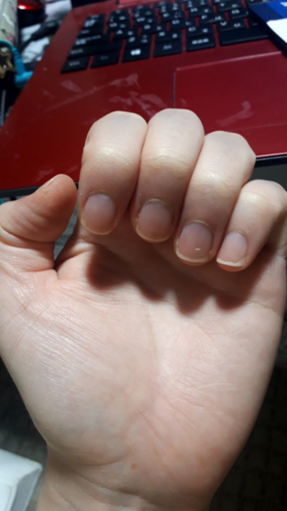 私の爪の形はあまり綺麗ではないでしょうか 最近は爪切りではなくヤ Yahoo 知恵袋