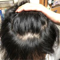 私は俗に言う全スカの男子高校生です 今まで猫っ毛で細く柔らか Yahoo 知恵袋