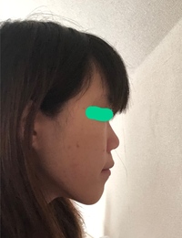 不織布のマスクをつけると横顔がクレヨンしんちゃんやムーミンみたいになります Yahoo 知恵袋