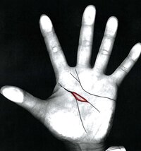 手相に詳しい方 教えてください 生命線と知能線の分岐点あたりに 島 み Yahoo 知恵袋