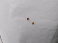 閲覧注意 耳掃除をしていたらこんなものがでてきたのですがなにかわかる Yahoo 知恵袋