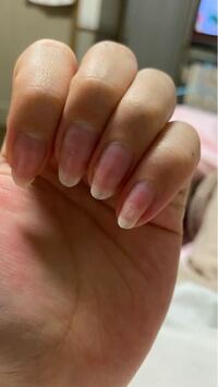 小指と薬指のネイルベットが半分ほど剥がれてきました 初 Yahoo 知恵袋