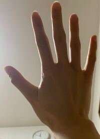 女の人の手に見えないぐらいごつい自分の手が嫌いです 手 Yahoo 知恵袋