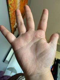 前から気にしているのですが 私は生命線が途中で途切れています 修学旅行の時に Yahoo 知恵袋