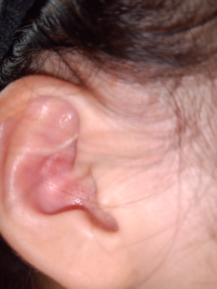 痛い 耳 の 入り口 耳が痛い時、原因として考えられるもの9つ！