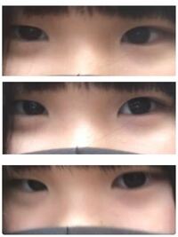 目の大きさの違いについて 外カメで撮ってもらった写真です Yahoo 知恵袋