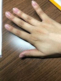 私は指の関節が黒いのが悩みです。 この指の黒ずみをなくす方法を教えてください