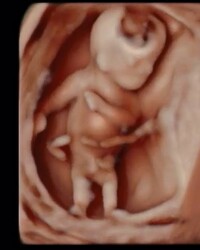 妊娠13週4日目のエコー写真です 性別分かりますか Yahoo 知恵袋