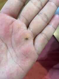 今日食べた生牡蠣の中に入っていたこの生き物は蟹ですか Yahoo 知恵袋