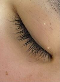 まぶたをみてもらったら分かるんですが白いポツポツとしたものが Yahoo 知恵袋