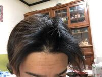 毛量多すぎてきついです これどうすればいいですかー Yahoo 知恵袋