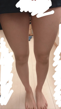 春から高校生になるのですが 制服のスカートから出る足がとても太くて悩 Yahoo 知恵袋