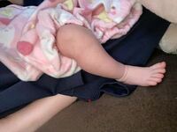 手足が細い赤ちゃん 体重が増えていてもミルクを足すべき こんにちは 2 Yahoo 知恵袋