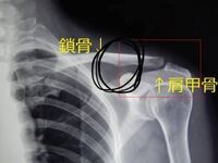筋肉痛 背中が痛くて重くて 呼吸が苦しいです 1週間前に猫背と反り腰を治そ Yahoo 知恵袋