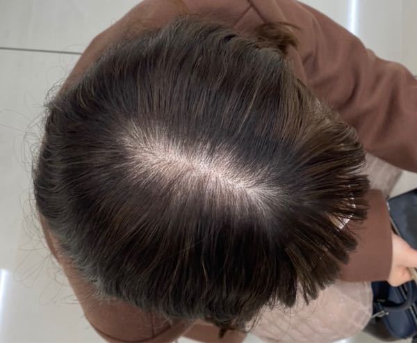 至急お願いします 写真あり 閲覧注意 21歳女です 私 Yahoo 知恵袋