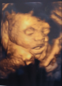 4dエコーで異常があれば指摘されますか 妊娠29週の妊婦です 今 Yahoo 知恵袋
