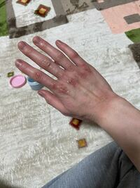 美容師アシスタント 手荒れが治りませんセルロイド使いすぎないように Yahoo 知恵袋