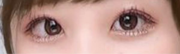 黒目の位置が左右で違うのですがこれはなんなのでしょうか いつも写真を見 Yahoo 知恵袋