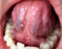 医療関係者の方 よろしくお願い致します 今日ふと舌の Yahoo 知恵袋