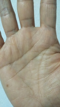 指の間から出ている線、これは金星帯ですか？真っ直ぐだからちがうでしょうか？ 写真は右手ですが、左手にもあります。手相に詳しい方にみていただけるとうれしいです。よろしくお願いします。