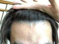 生え際だ白い頭皮がみえるのは ふつうですか Yahoo 知恵袋