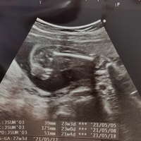 妊娠23週です女の子男の子どちらだと思いますか エコーだけ見ると女の子 Yahoo 知恵袋