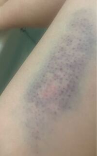 怪我した彼氏にかける言葉は何 彼氏が怪我しました 時が Yahoo 知恵袋