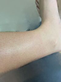 足に赤い小さな斑点があります 写真を見て貰えると分か Yahoo 知恵袋