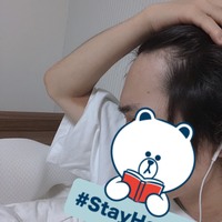 前髪は後退してますか 髪を生やすなら移植が確実だと聞きました いま23 Yahoo 知恵袋